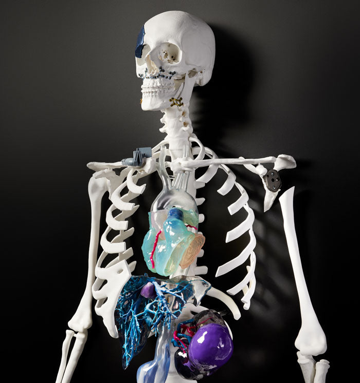 Encore un Bénéfice de l'Impression 3D pour le Domaine de la Santé